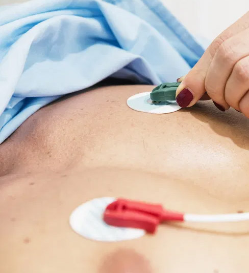 eletrocardiograma
