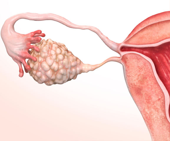 medico-endocrinologista-rio-de-janeiro-tratamentos-6